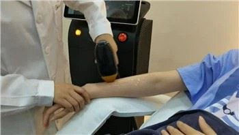 Stroj za uklanjanje dlačica s laserskom diodom s optičkim vlaknima