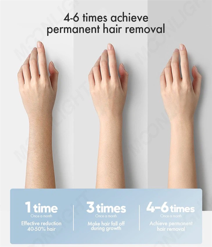 Full Body Treatment Laser Hair Removal Machine